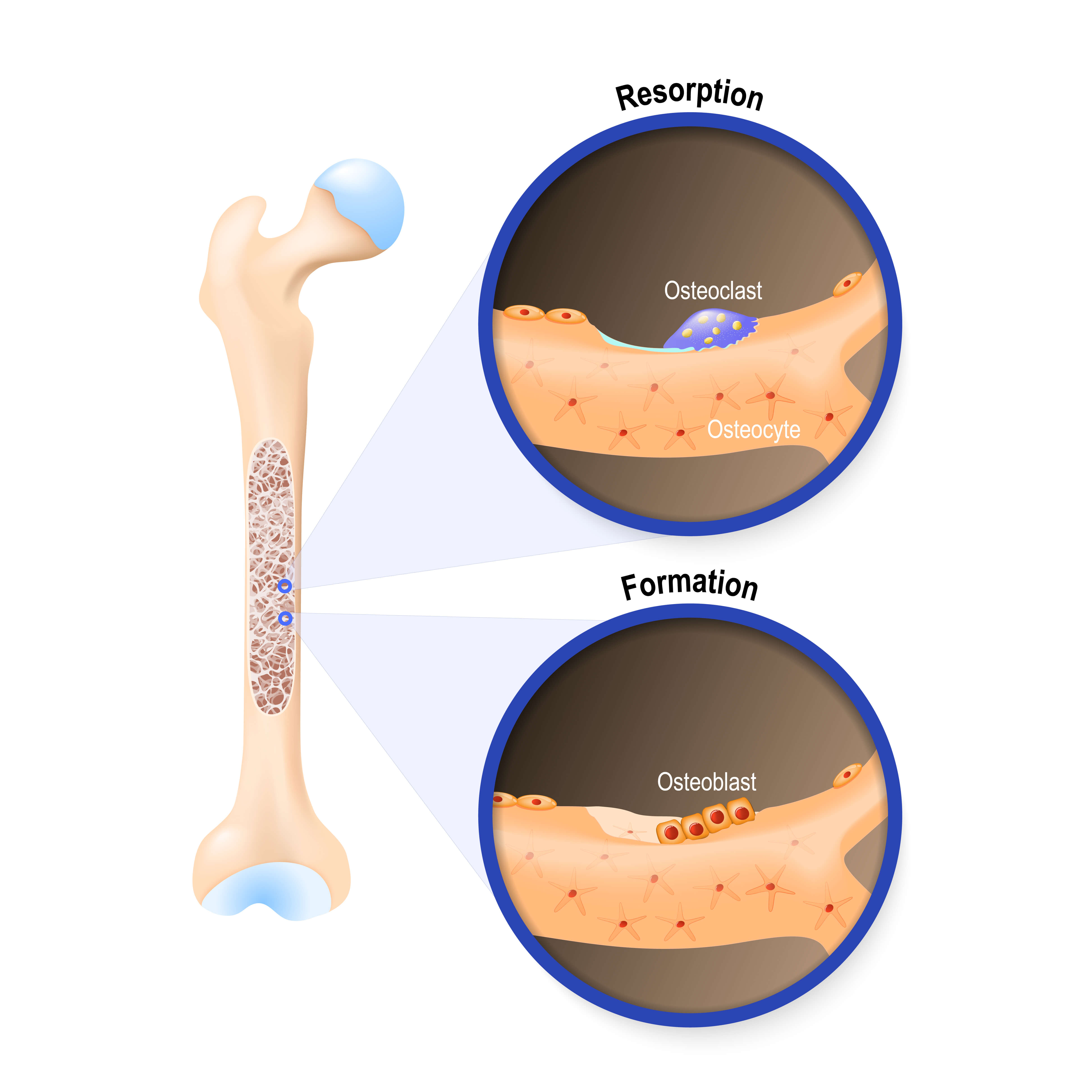 Understanding Bone Resorption Aquidneck Chiropractic