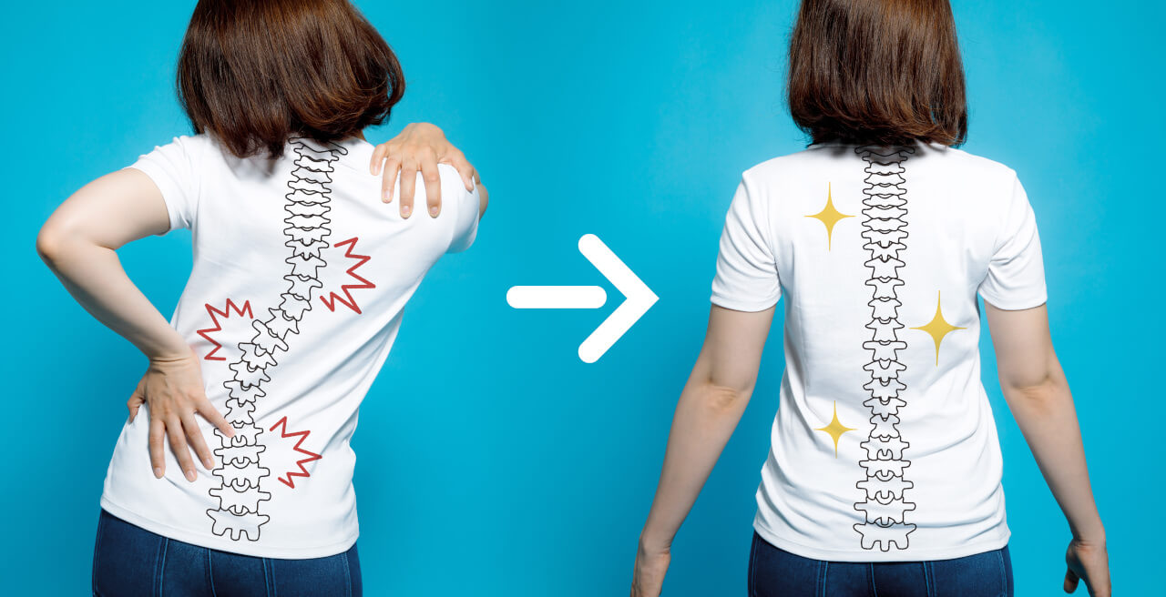Can A Chiropractor Fix Scoliosis?